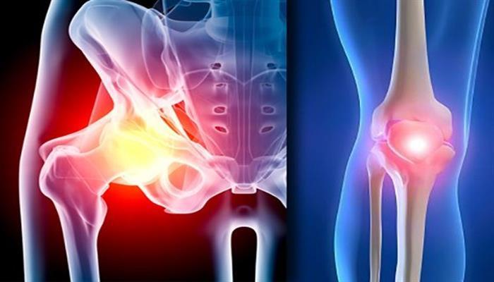 Better care for hip and knee problems: Quality contract should avoid unnecessary surgery
