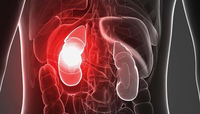 30-prozentige Risikoreduktion: SGLT2-Hemmer Canagliflozin verlangsamt das Nierenversagen bei Patienten mit Typ-2-Diabetes